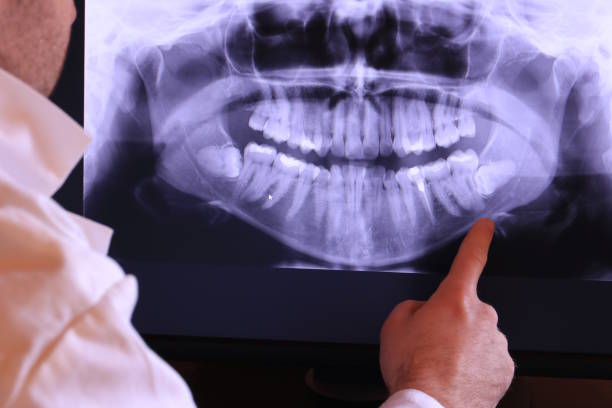 Dentist for Dental Trauma in OK