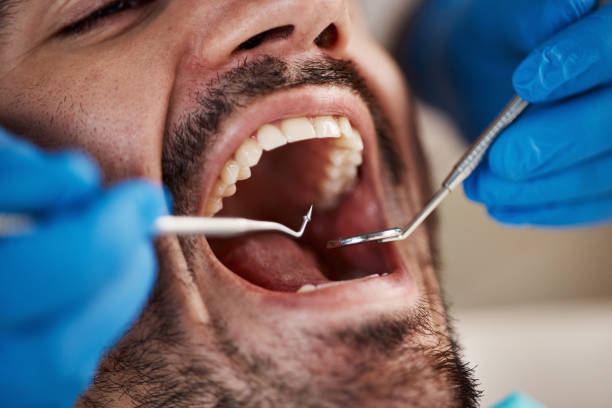 Best Dentist for Tooth Abscess  in Pryor Creek, OK