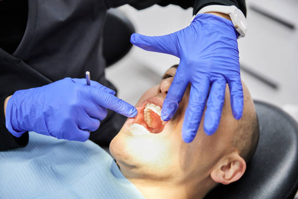 Best Chipped Tooth Repair Near Me  in Pryor Creek, OK